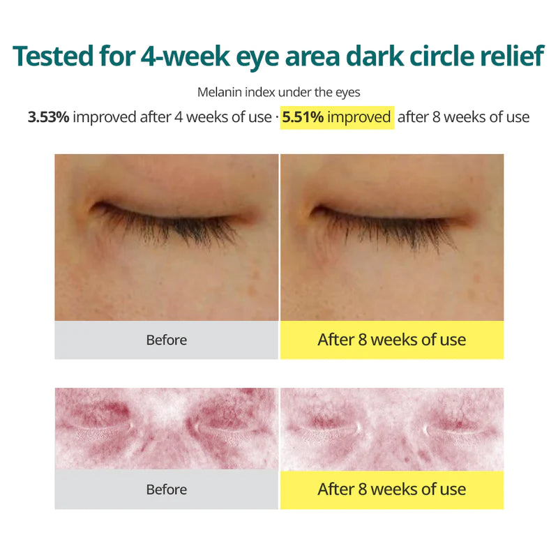 Goodal Green Tangerine Vita C Dark Spot Care Eye Cream Set