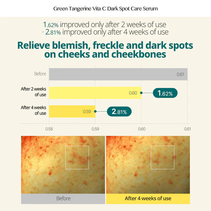 Goodal Green Tangerine Vita C Dark Spot Care Serum Set